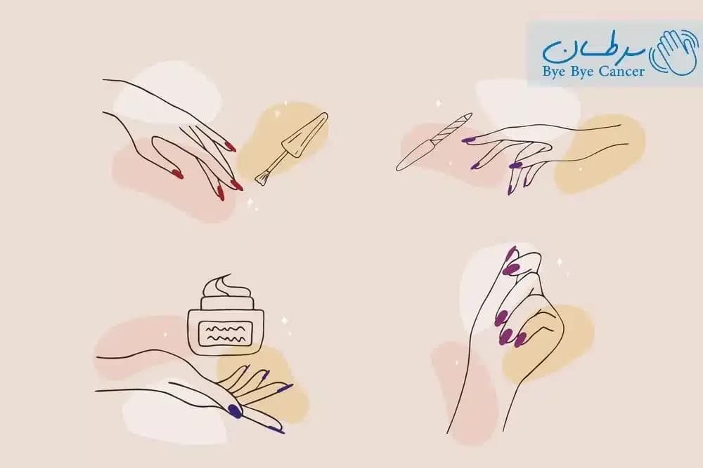 کاشت ناخن و سرطان