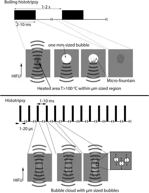 new-method-of-liver-cancer-treatment.webp