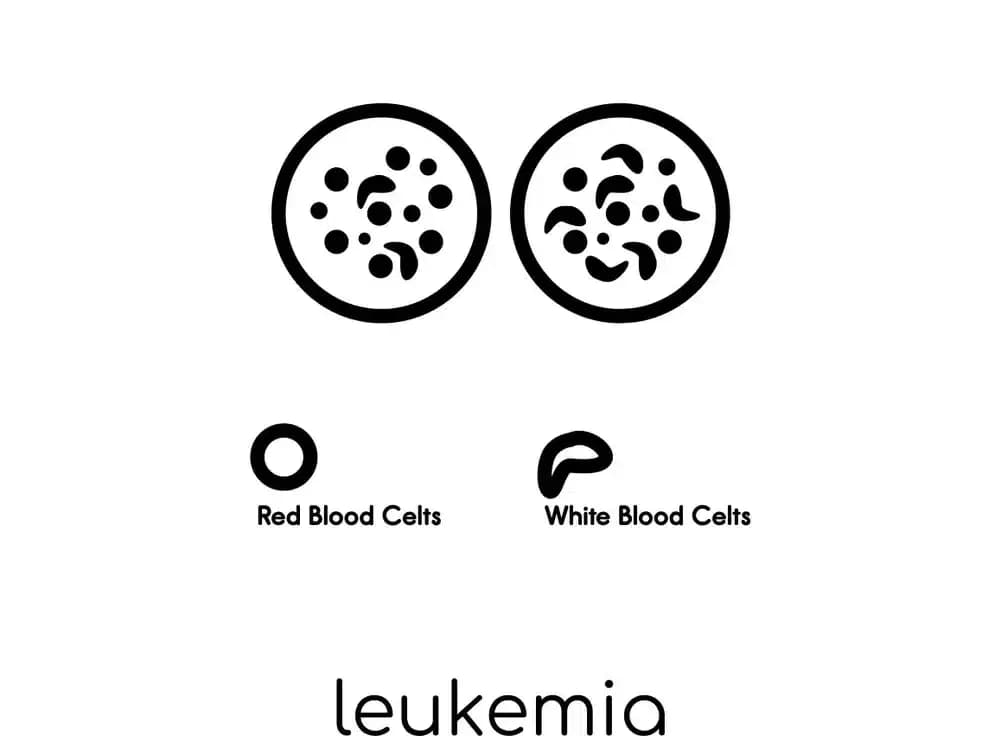 patients-with-CML.1-edited.webp