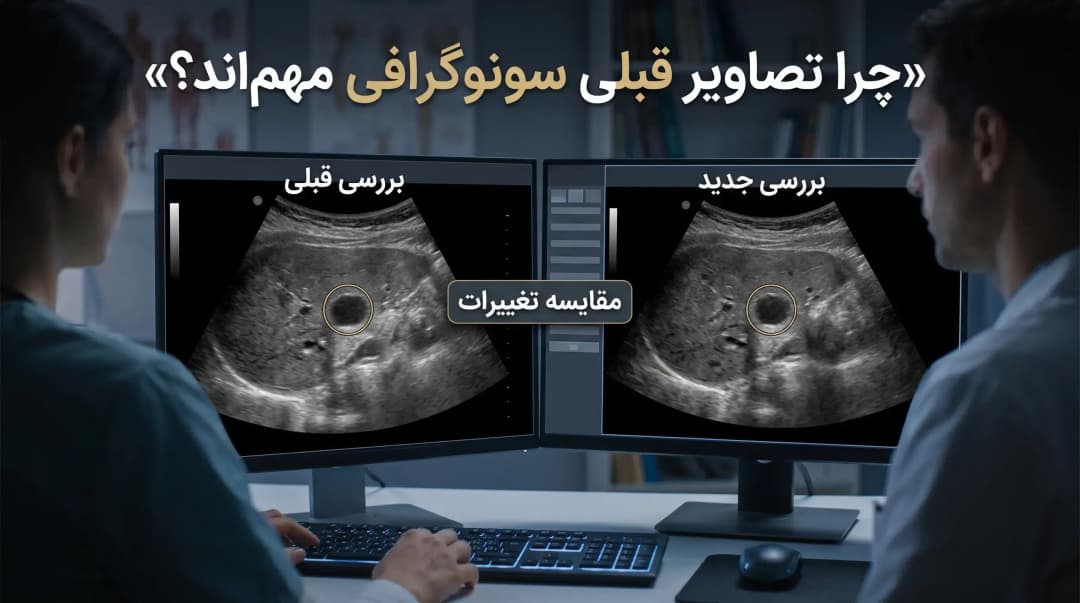 سونوگرافی بعد از درمان سرطان