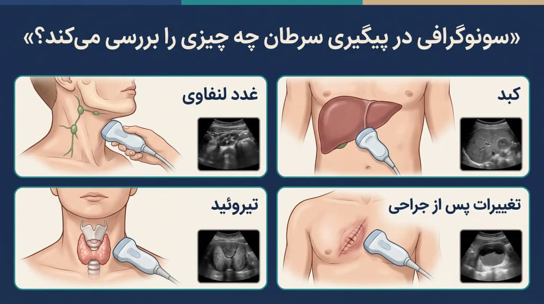 سونوگرافی بعد از درمان سرطان