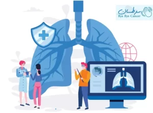 سرطان دهان