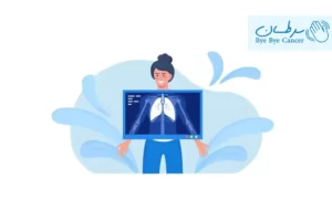 اشعه ایکس