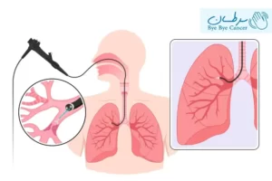 مدیاستینوسکوپی