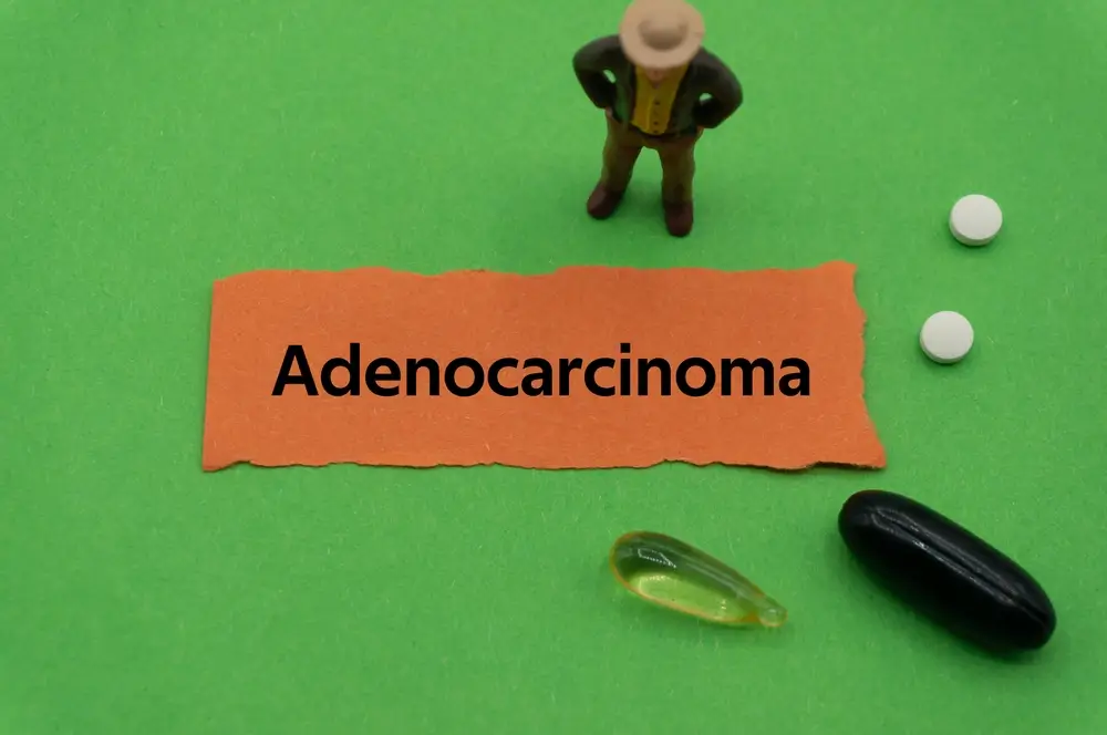 adenocarcinoma