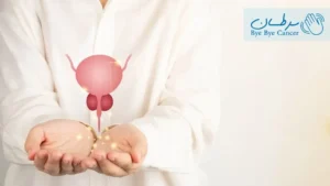 دکتر سرطان پروستات