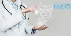 دکتر سرطان کولورکتال