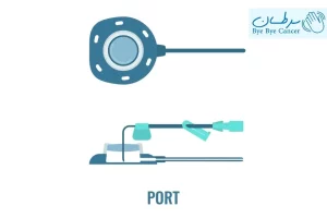 پورت شیمی درمانی