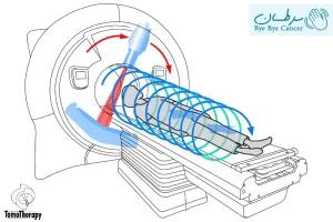 توموتراپی