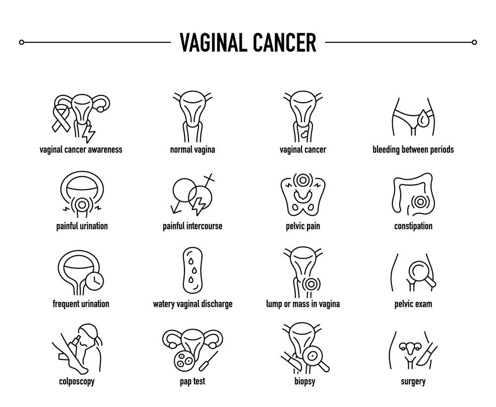 عوارض فیزیکی سرطان واژن
