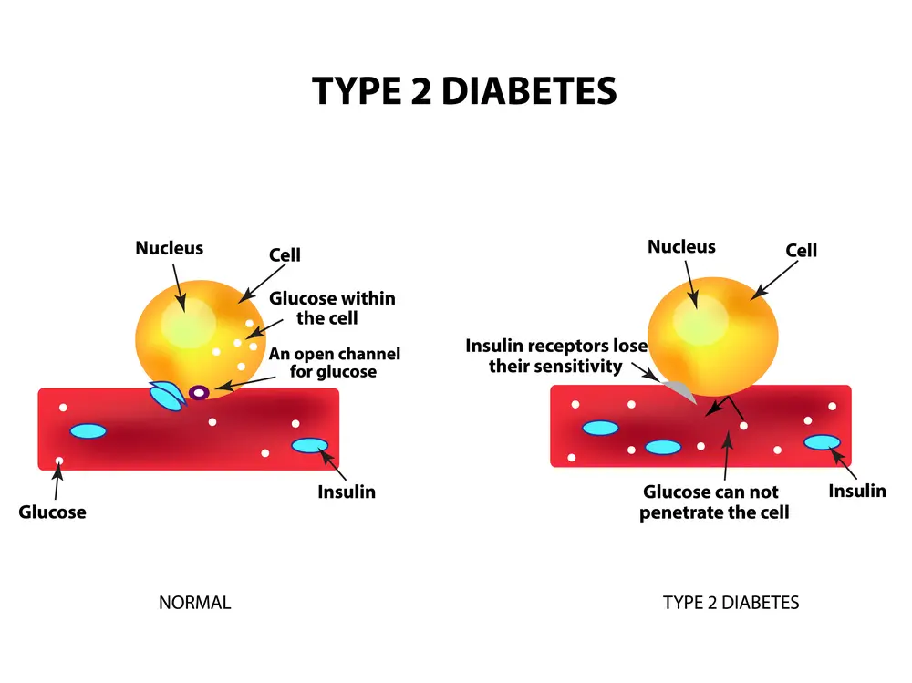 سرطان آندومتر در افراد مبتلا به دیابت نوع ۲