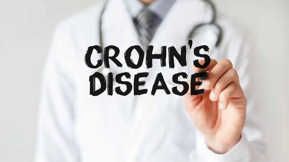 crohns disease.1