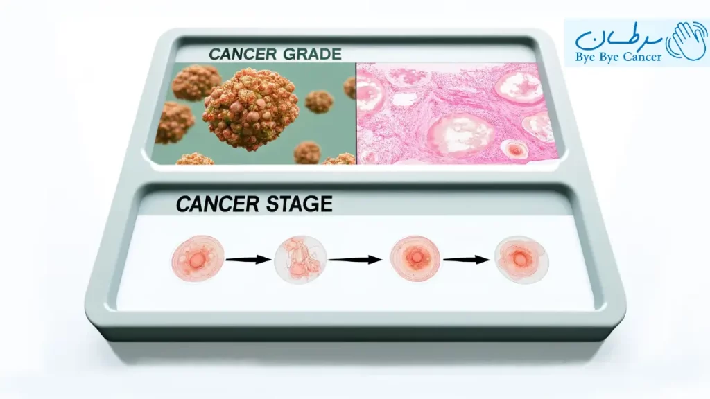 تفاوت گرید و استیج در سرطان