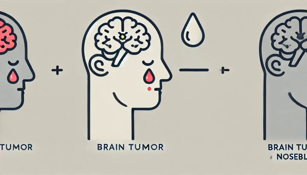 تومور مغزی و خون دماغ شدن