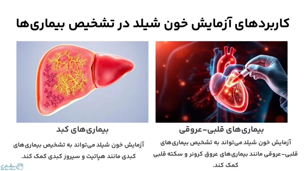 کاربرد‌های آزمایش خون شیلد در تشخیص بیماری‌ها