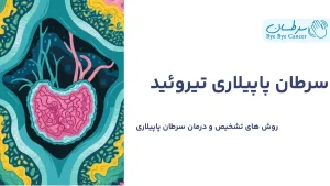 سرطان پاپیلاری