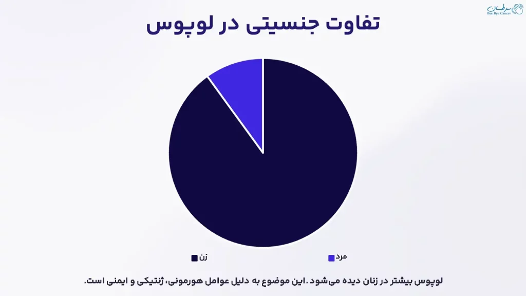 تفاوت جنسیتی در لوپوس