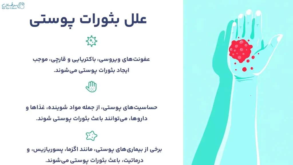 علل بثورات پوستی