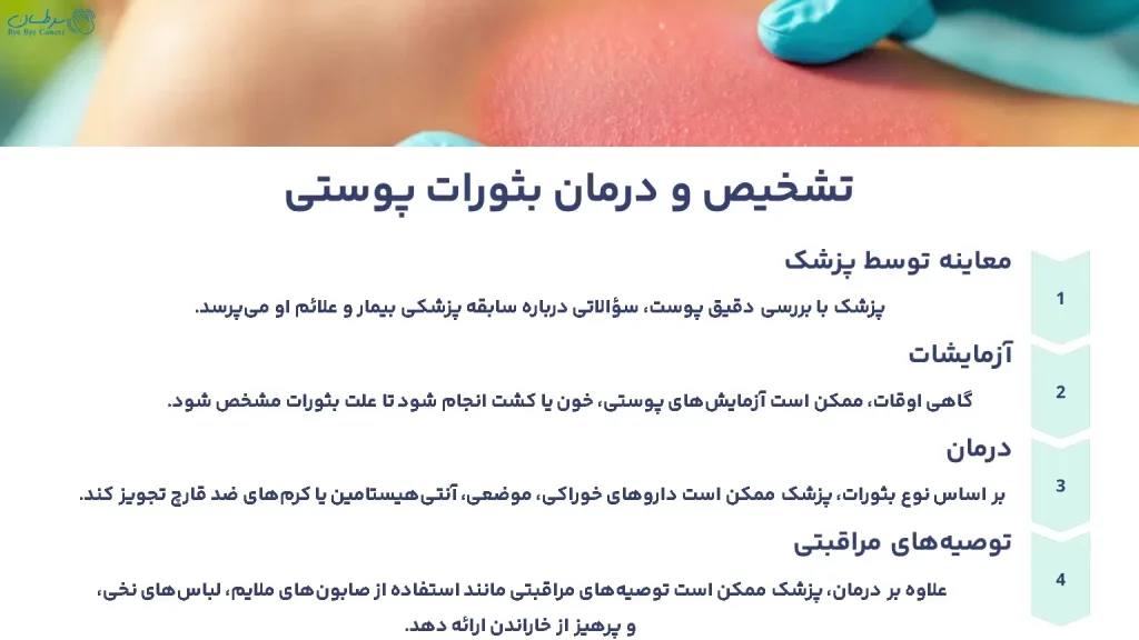 تشخیص و درمان بثورات پوستی