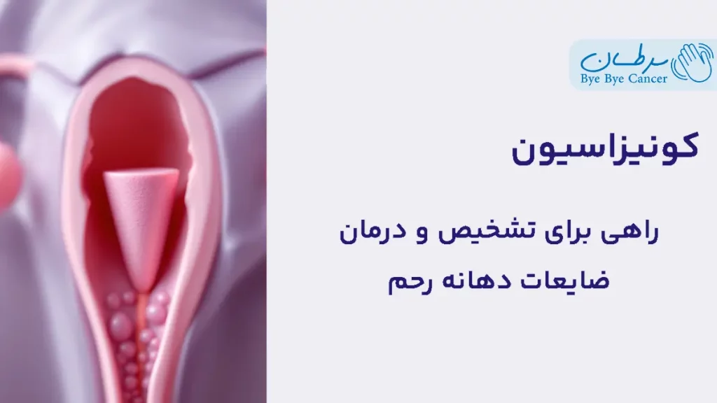 کونیزاسیون