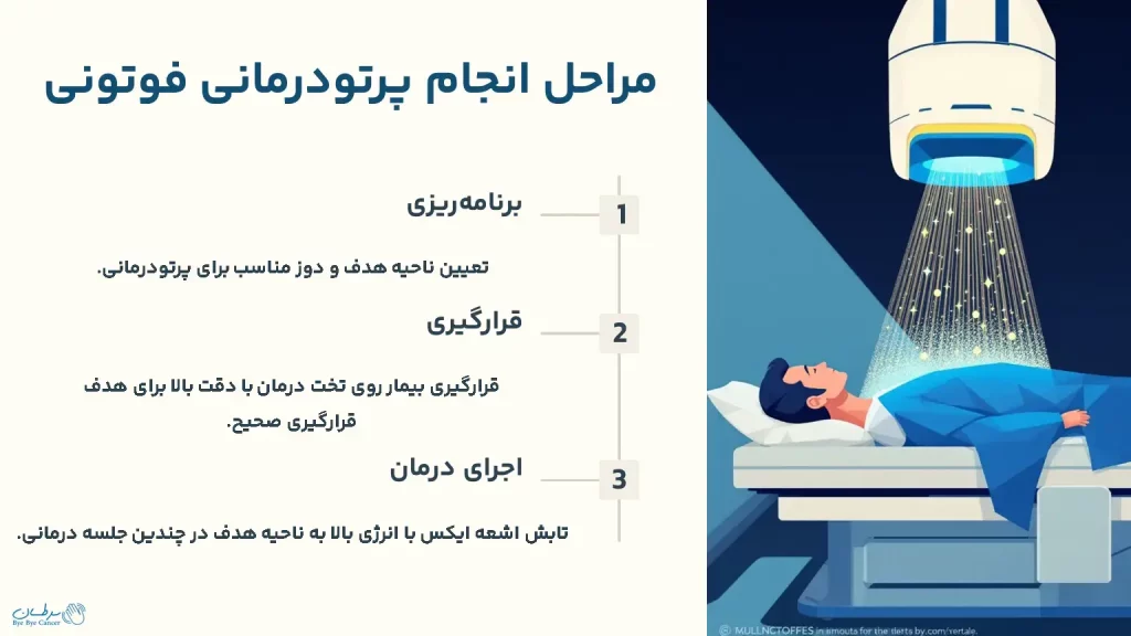 مراحل انجام پرتودرمانی فوتونی