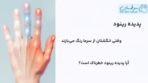 پدیده رینود