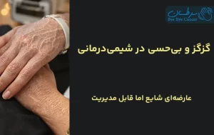 گز گز دست و پا در حین شیمی درمانی