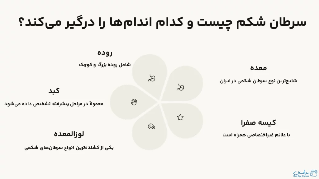 سرطان شکم