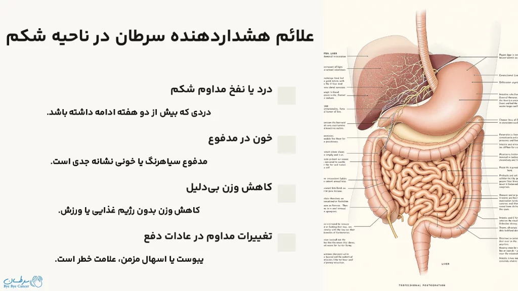 سرطان شکم