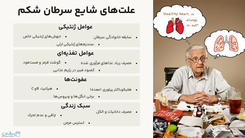 سرطان شکم