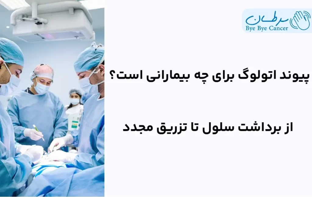 پیوند اتولوگ