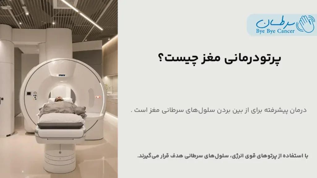 پرتو درمانی مغز