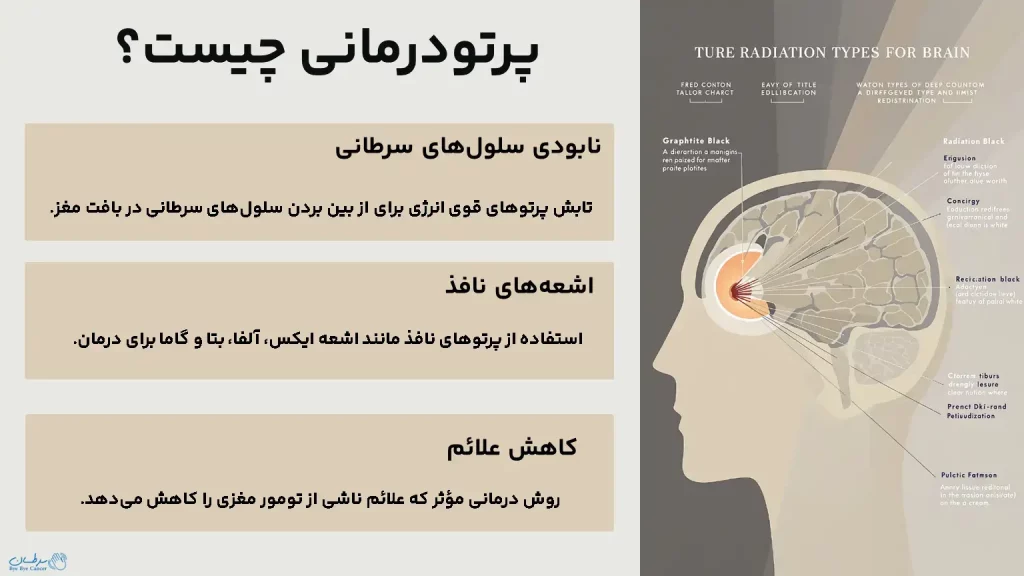 پرتو درمانی مغز