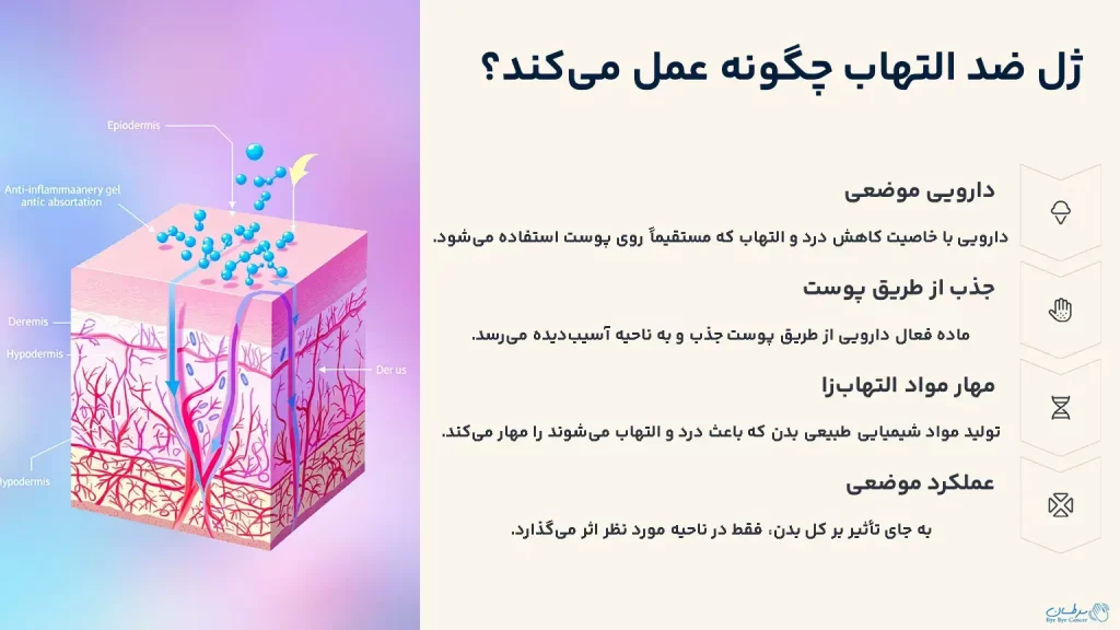 ژل‌های موضعی ضد التهاب
