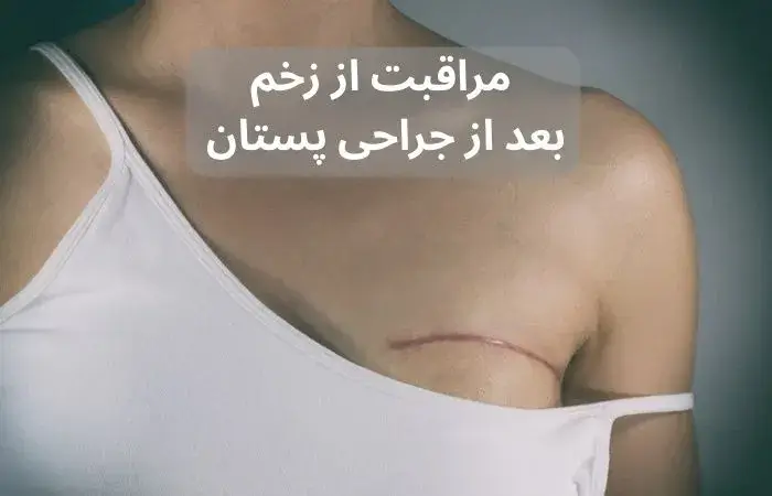 مراقبت از زخم بعد از جراحی سرطان