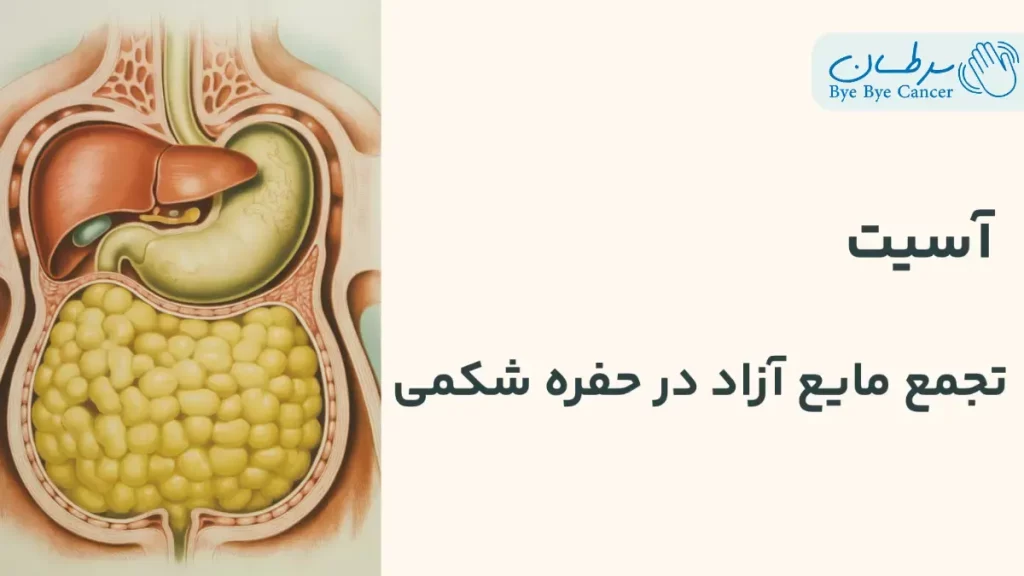 آسیت