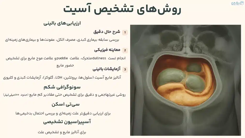 روش‌های تشخیص آسیت