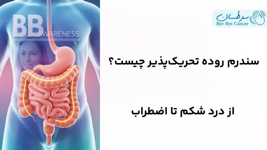 سندروم روده