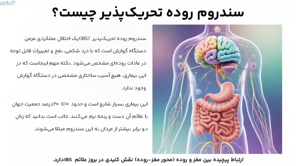 سندرم روده تحریک‌پذیر چیست؟
