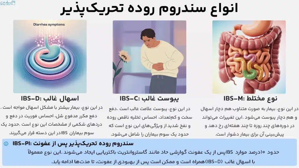 انواع سندروم روده تحریک‌پذیر