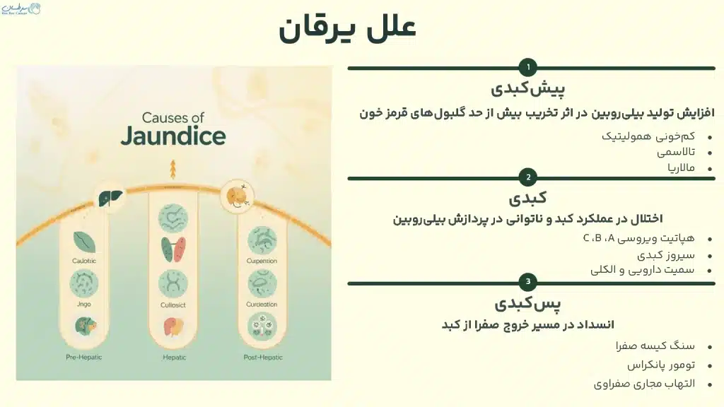 علل یرقان