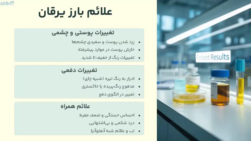 علائم بارز یرقان