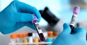 چند روز قبل از آزمایش خون نباید مشروب خورد